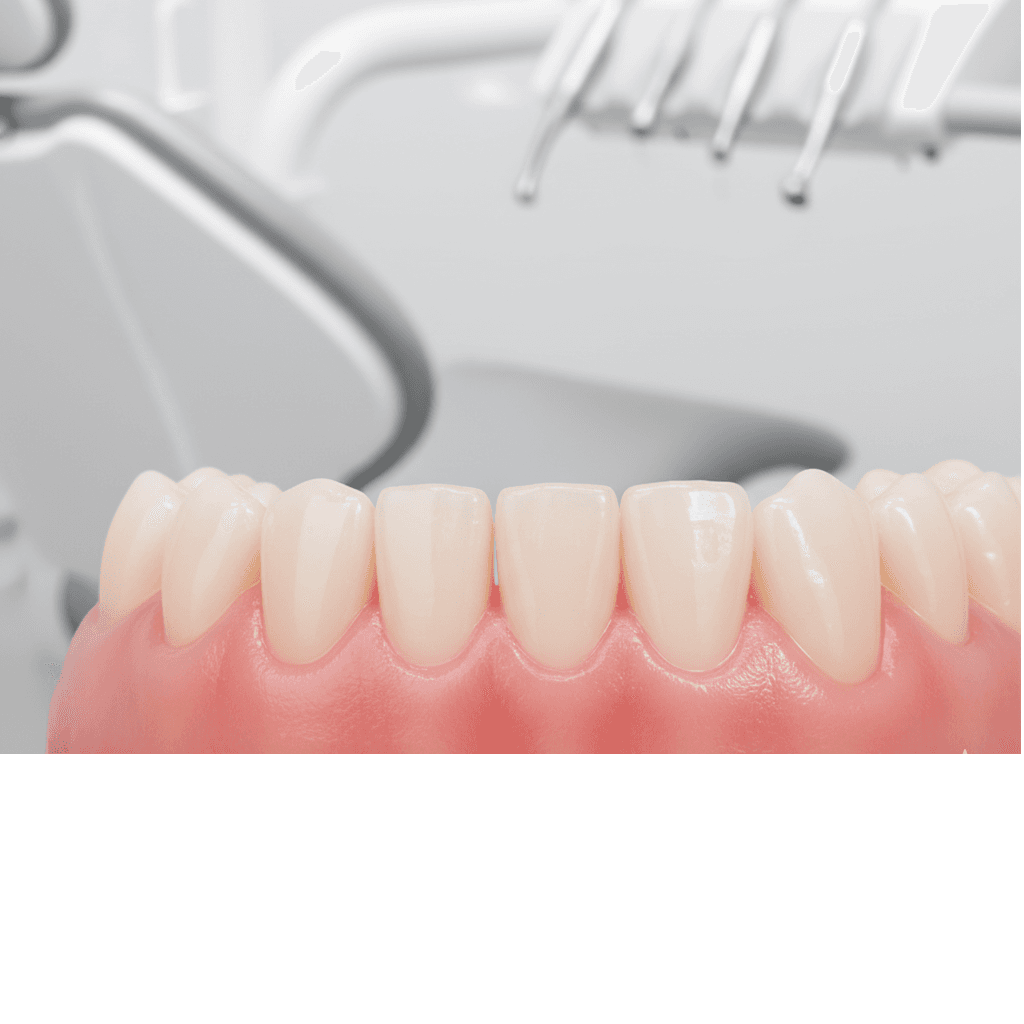 Лечение десен